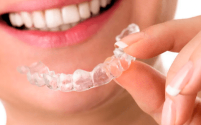 Alinhadores invisíveis permitem corrigir dentes tortos mais rápido