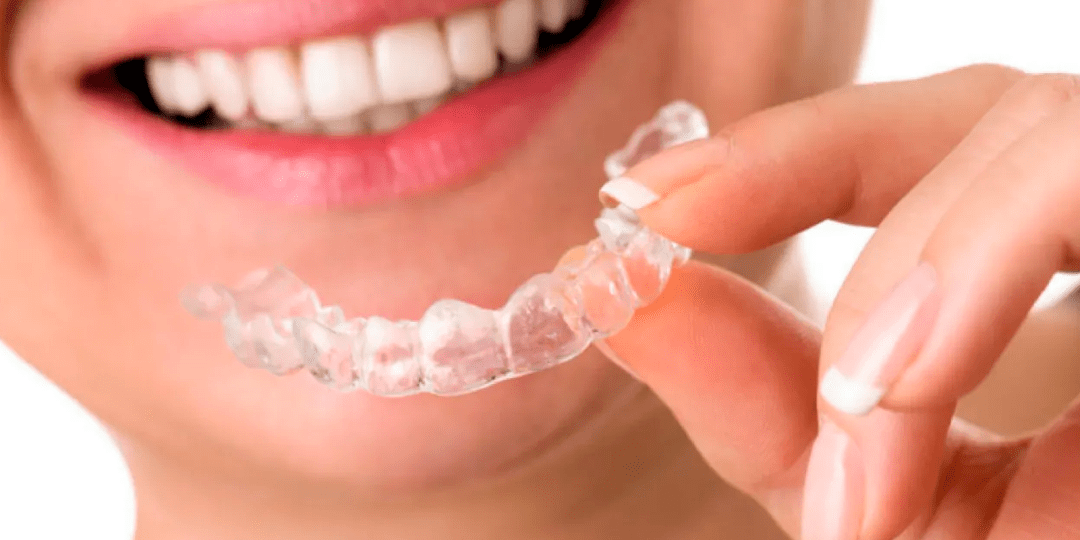 Alinhadores invisíveis permitem corrigir dentes tortos mais rápido