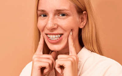 Apertamento dental: o que é, como identificar e tratar