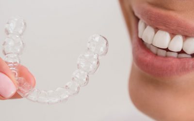 3 dicas para manter o clareamento dental